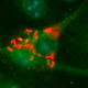 Legionella pneumophila bacteria. Photo Courtesy of Brenda Byrne / University of Michigan